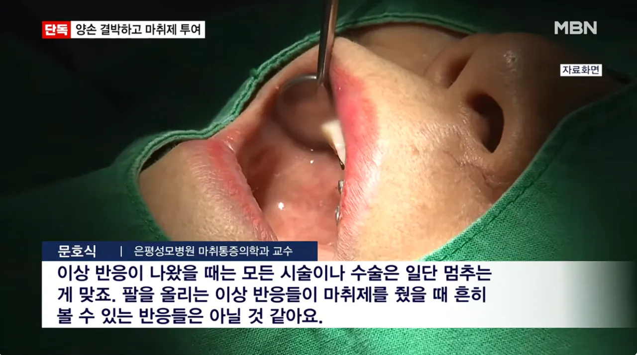 임플란트 사망 CCTV 봤더니 수술대에 양손 결박 후 마취제 투여 (12)