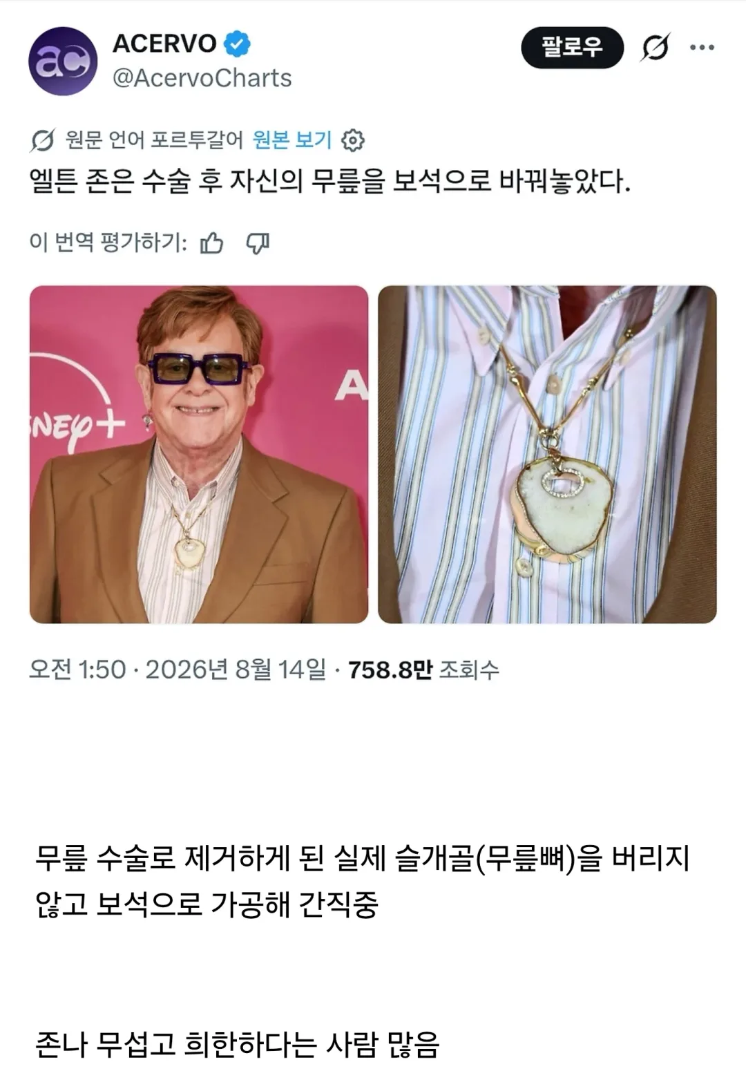 무섭다는 반응 많은 엘튼존 목걸이 (2)