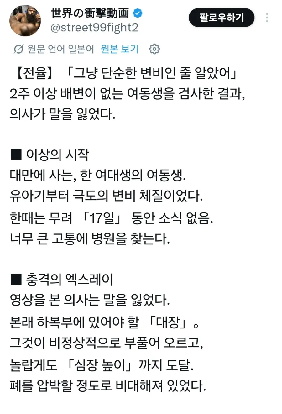 변비 조심 하세요 (2)