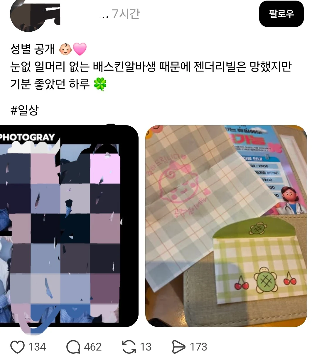 신종 '젠더 리빌' 진상, SNS에서 화제 (2)