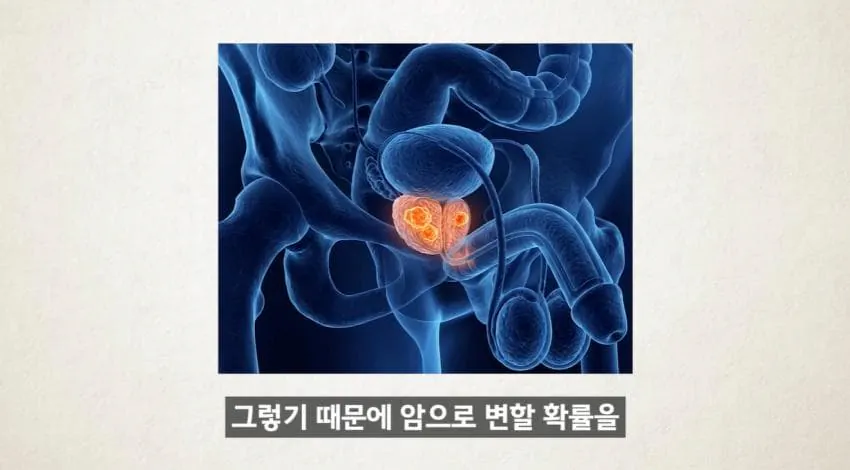 “한 달에 21번 사정하라!" (36)