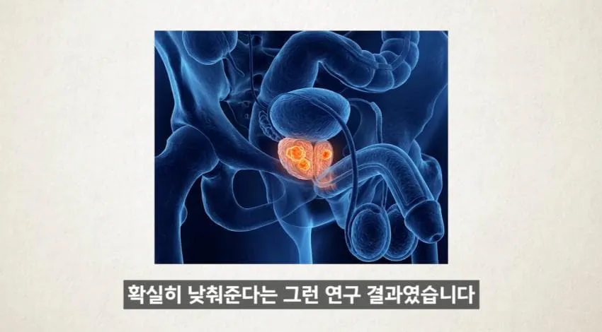 “한 달에 21번 사정하라!" (37)