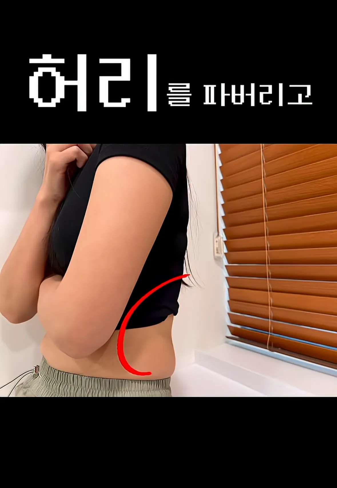 요즘 여자들 사이에 유행중인 신종 몸매 성형수술 허파고리 수술 (19)