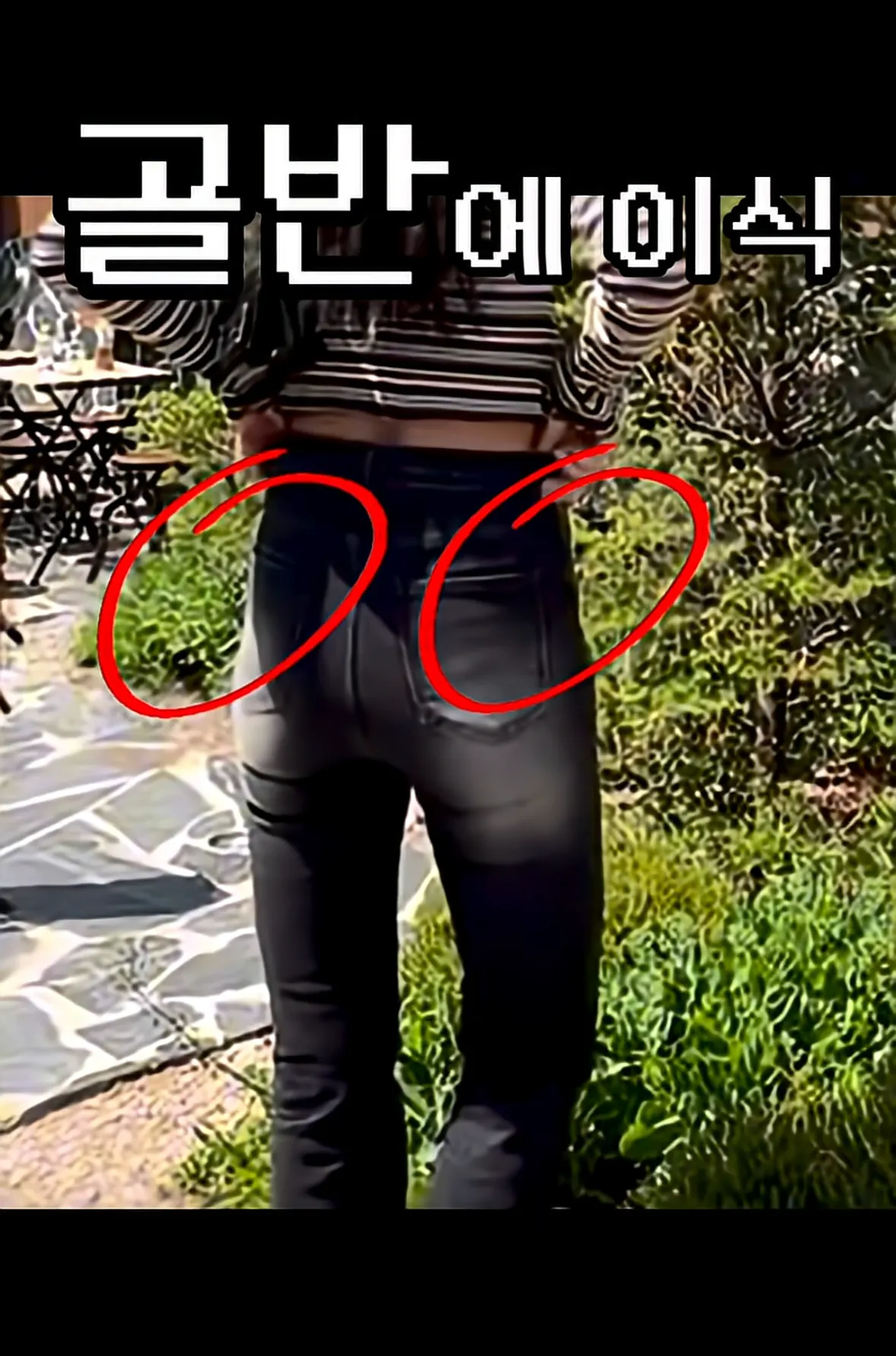 요즘 여자들 사이에 유행중인 신종 몸매 성형수술 허파고리 수술 (20)
