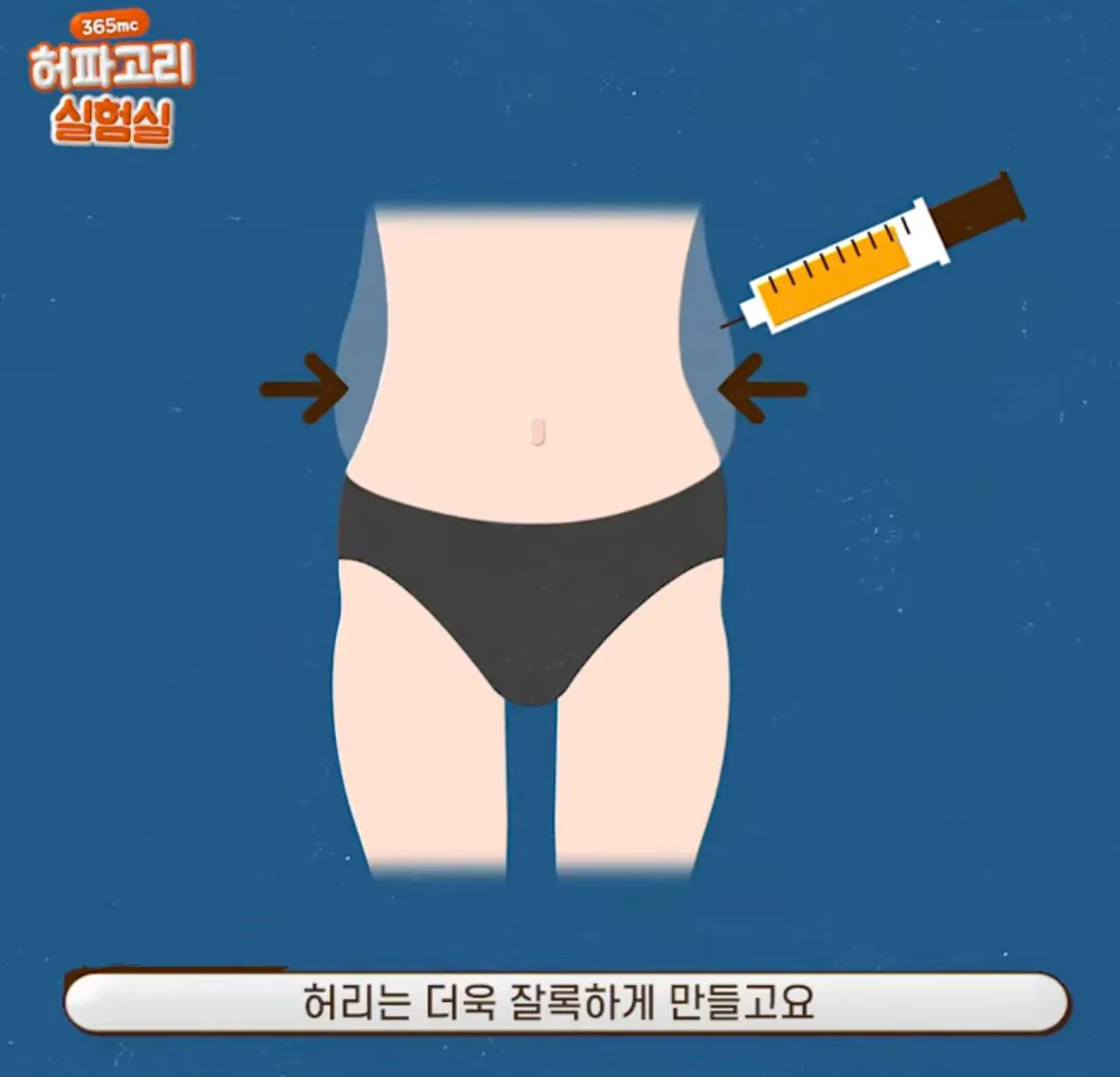 요즘 여자들 사이에 유행중인 신종 몸매 성형수술 허파고리 수술 (2)