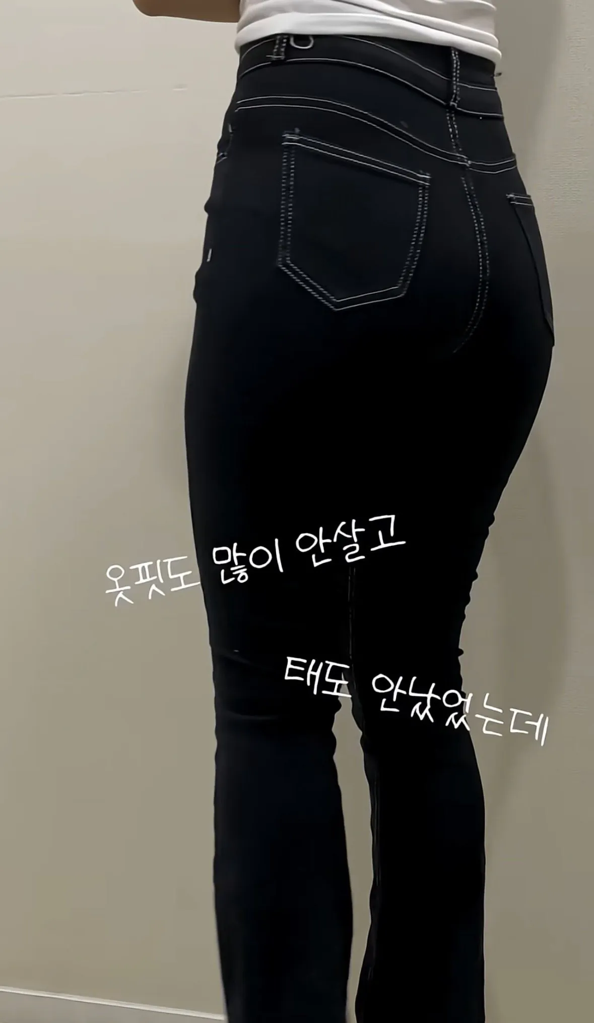 요즘 여자들 사이에 유행중인 신종 몸매 성형수술 허파고리 수술 (6)