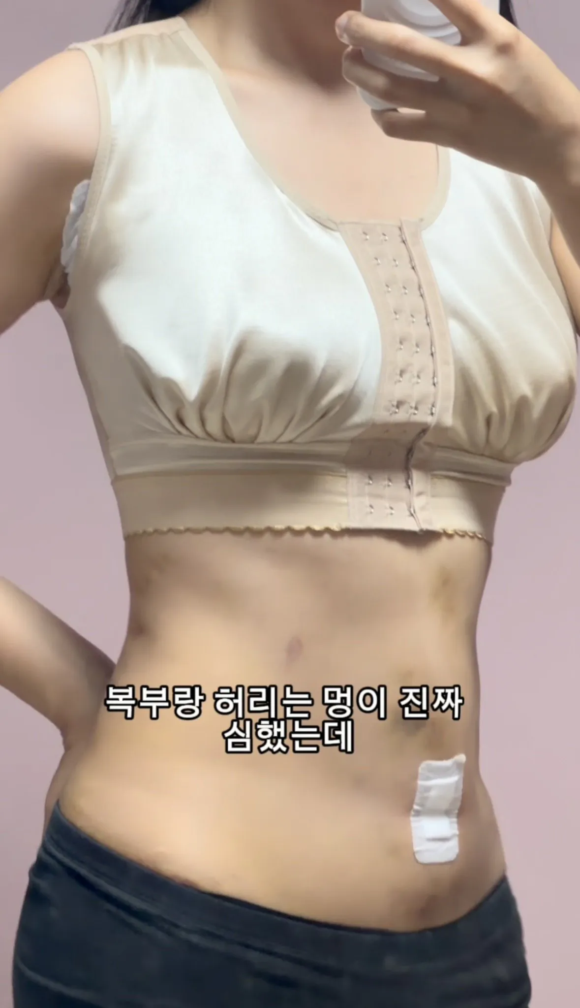 요즘 여자들 사이에 유행중인 신종 몸매 성형수술 허파고리 수술 (10)