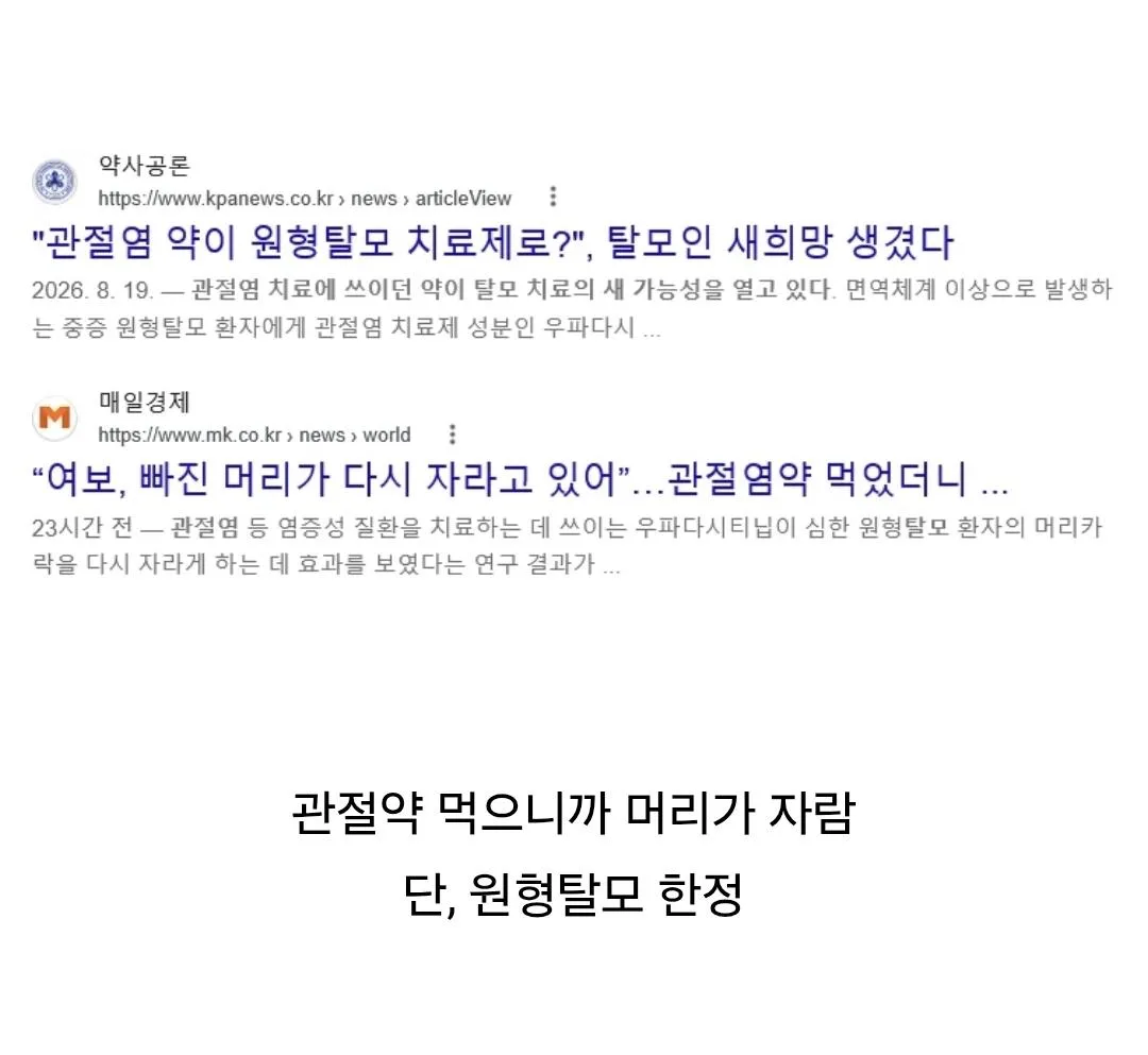관절염 약 먹었더니…"머리카락 80% 다시 자랐다" (2)