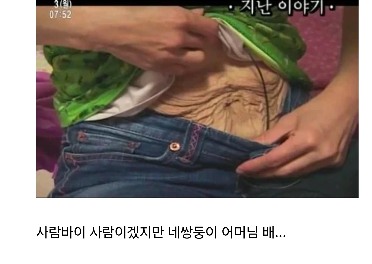 애기 셋 낳은 어머니 배 사진 논란 (3)