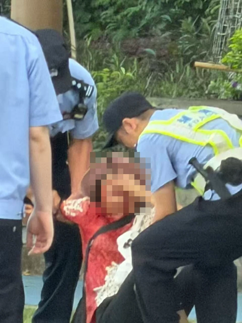 (극혐) 중국 광저우에서 발생한 얼굴만 노린 묻지마 칼부림 사건 (2)