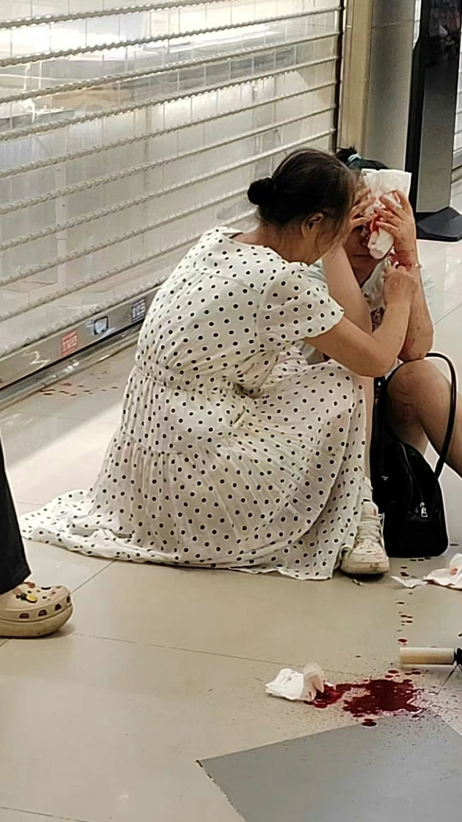 (극혐) 중국 광저우에서 발생한 얼굴만 노린 묻지마 칼부림 사건 (4)