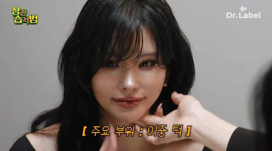 고령층에서 유행중인 시술 (8)