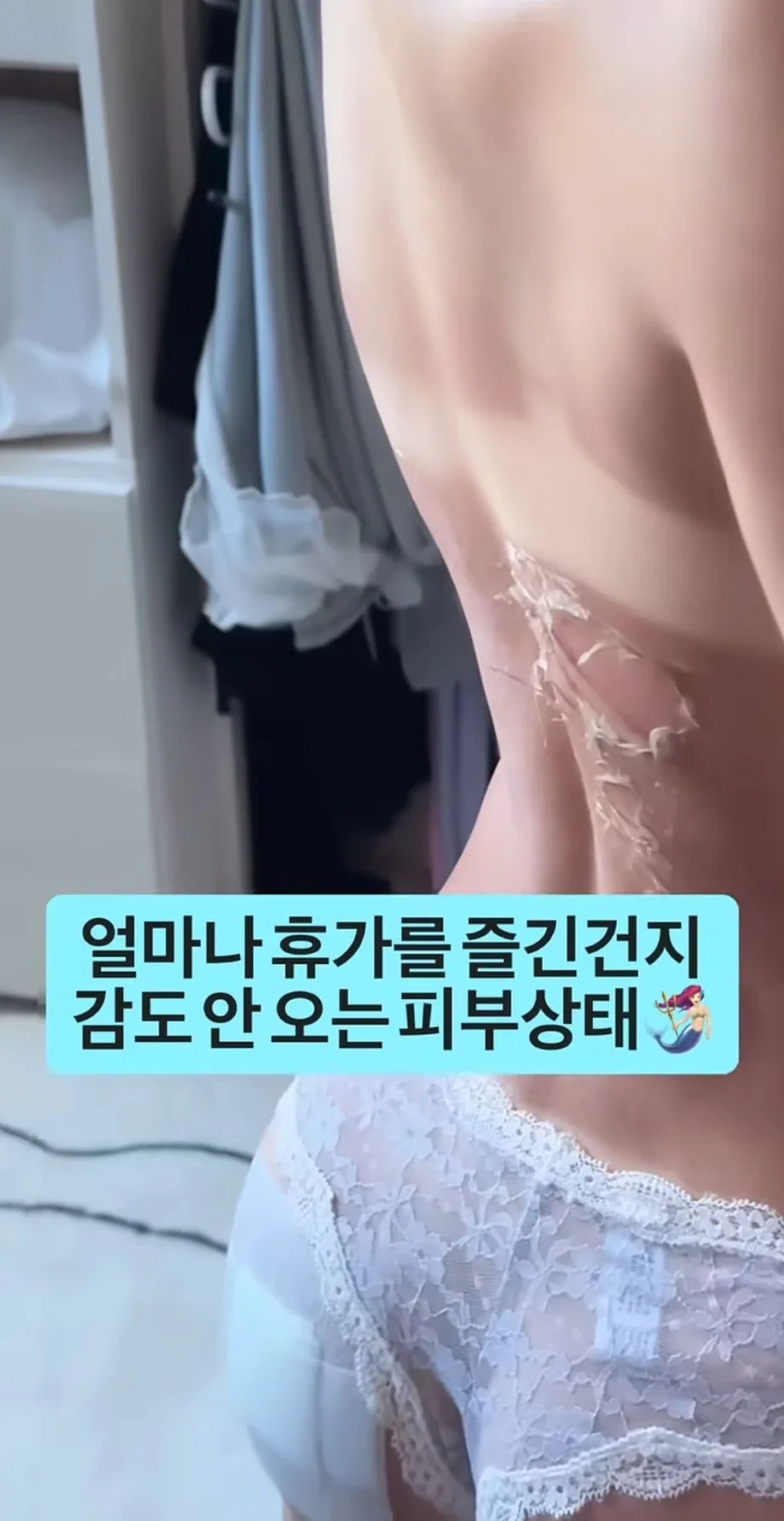휴가 갔다온 여자의 피부 상태.jpg (2)