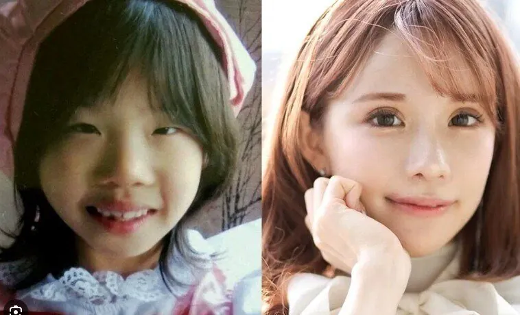 2억원치 성형결과 (3)