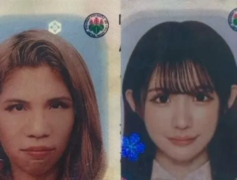 2억원치 성형결과 (5)