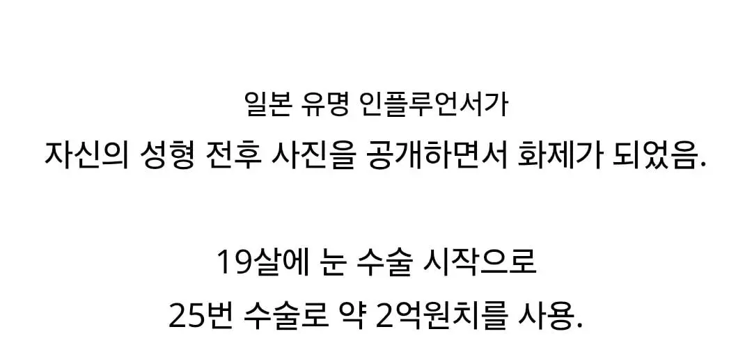2억원치 성형결과 (7)