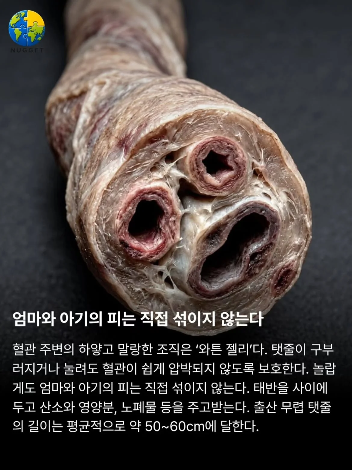 몰랐던 탯줄에 대한 이야기 (3)