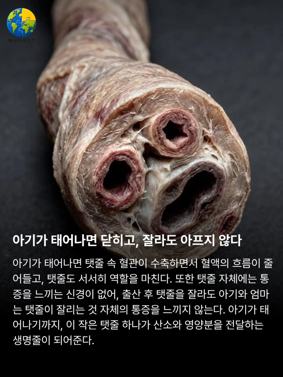 몰랐던 탯줄에 대한 이야기 (4)