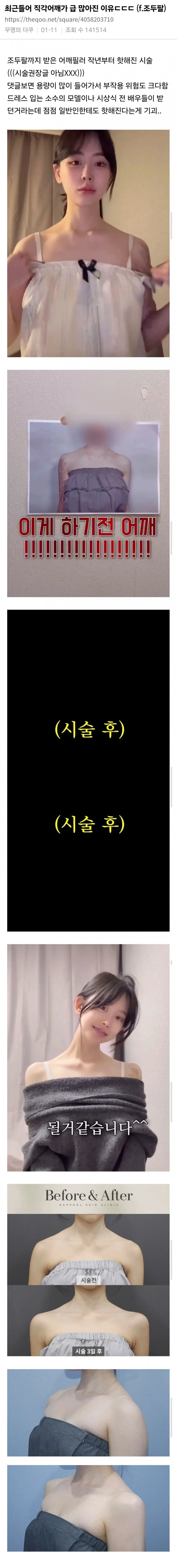 요즘 직각어깨가 급 많아진 이유
