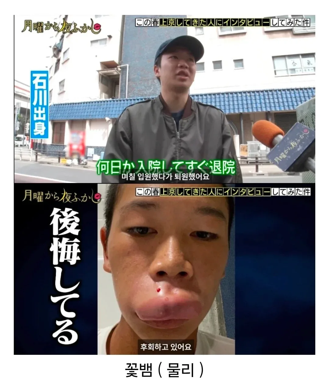 도쿄 상경하자마자 바로 꽃뱀에게 제대로 물린 일본 시골 청년 (4)