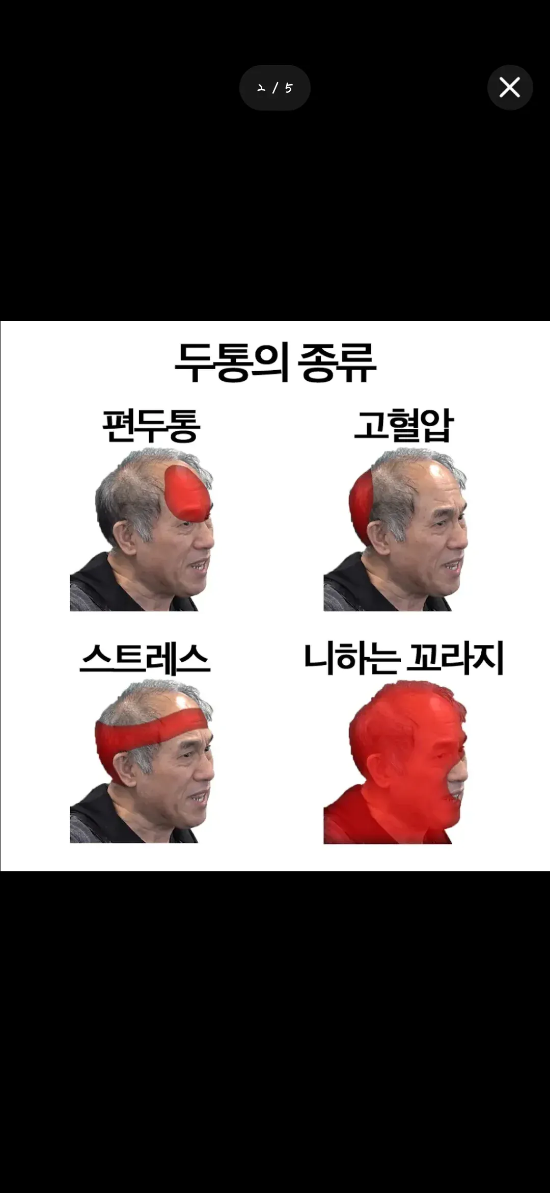 정일영 초상권 유출 관련 공지 (2)
