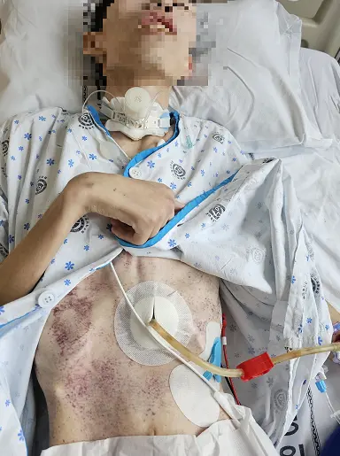17사단 원일병 사건 가족이 쓴 글 (3)
