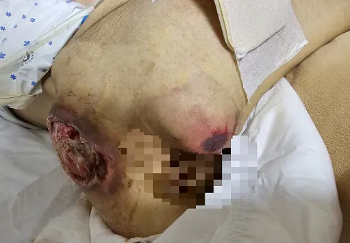 17사단 원일병 사건 가족이 쓴 글 (7)