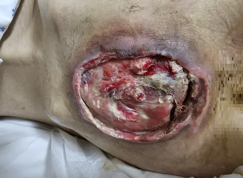 17사단 원일병 사건 가족이 쓴 글 (6)