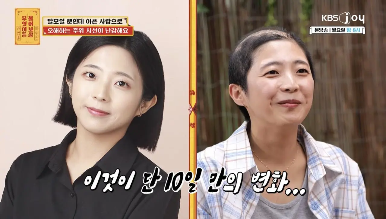 물어보살, 10일만에 탈모가 온 사람 (11)