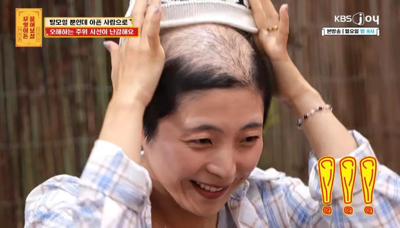 물어보살, 10일만에 탈모가 온 사람 (4)