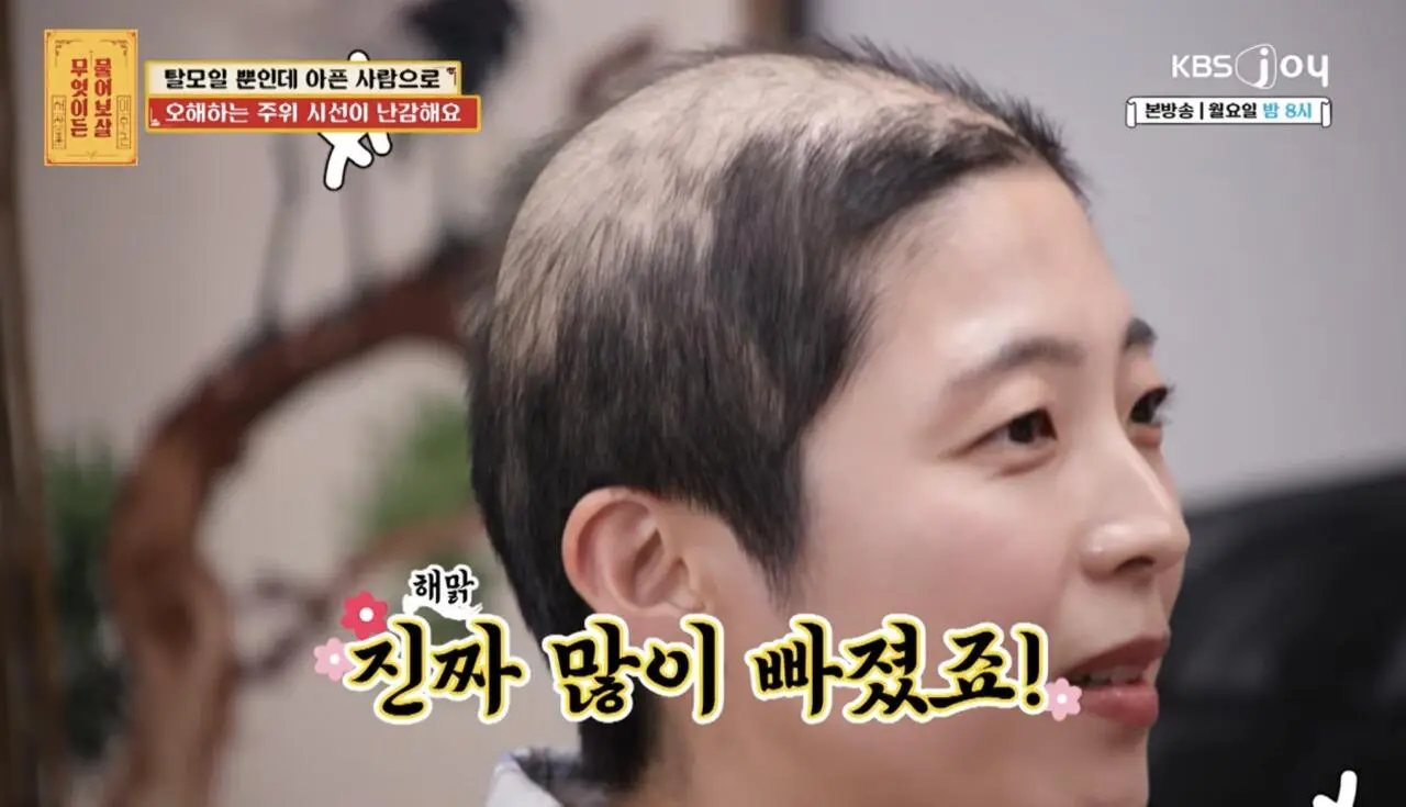 물어보살, 10일만에 탈모가 온 사람 (5)