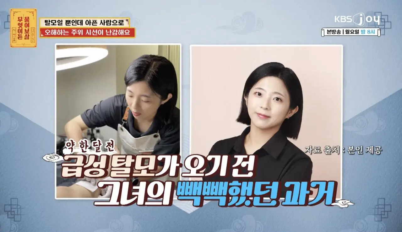 물어보살, 10일만에 탈모가 온 사람 (7)