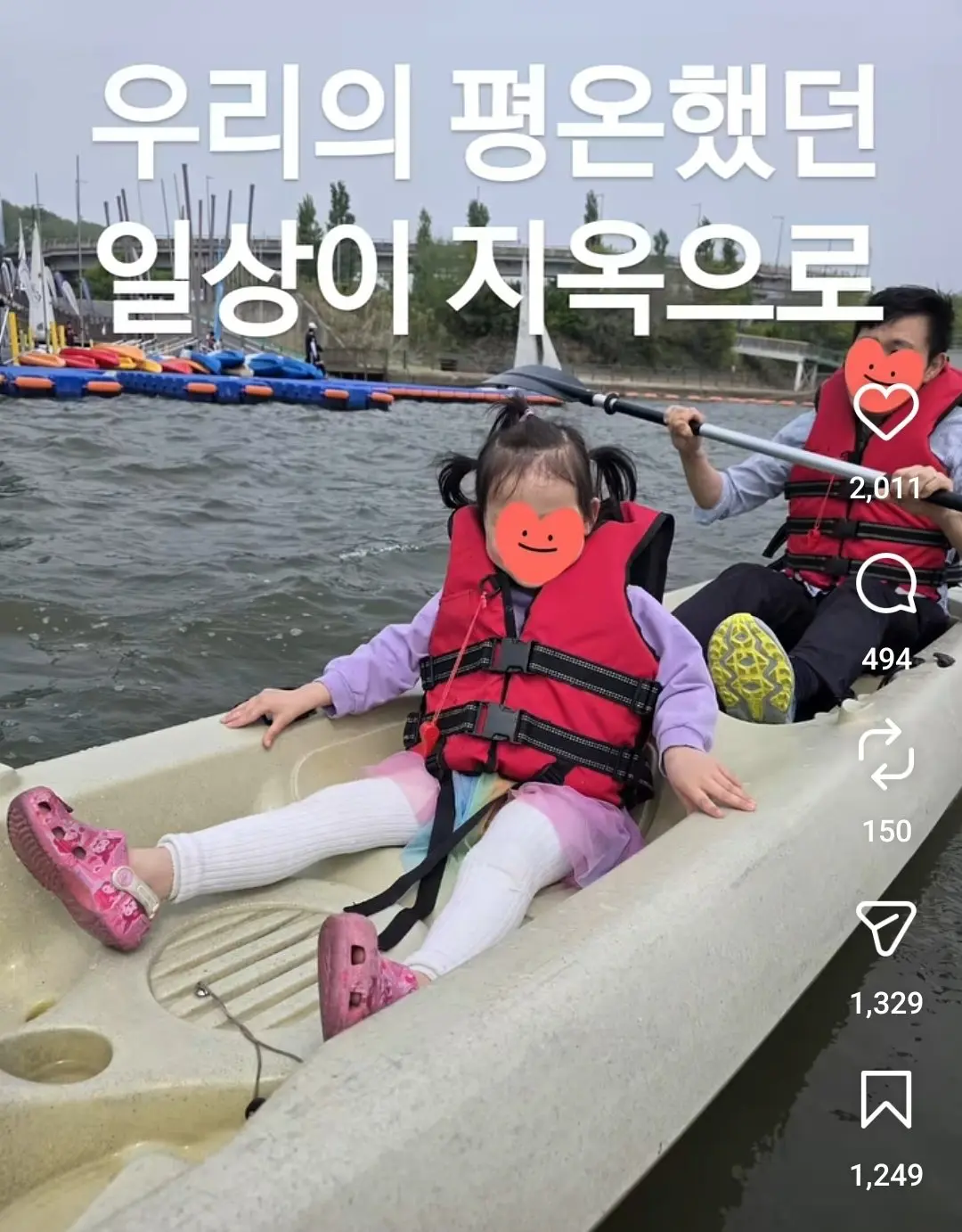 안마의자에 발 뼈가 분쇄된 6살 아이 (4)