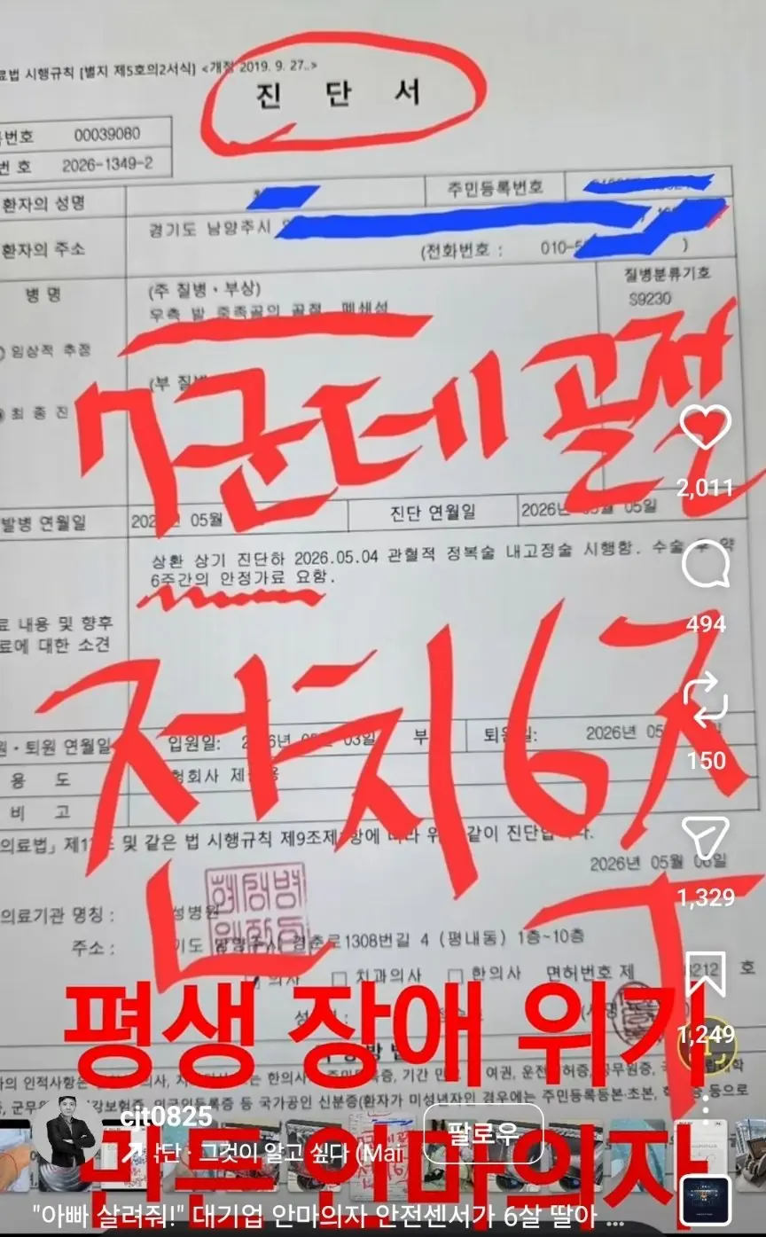 안마의자에 발 뼈가 분쇄된 6살 아이 (7)
