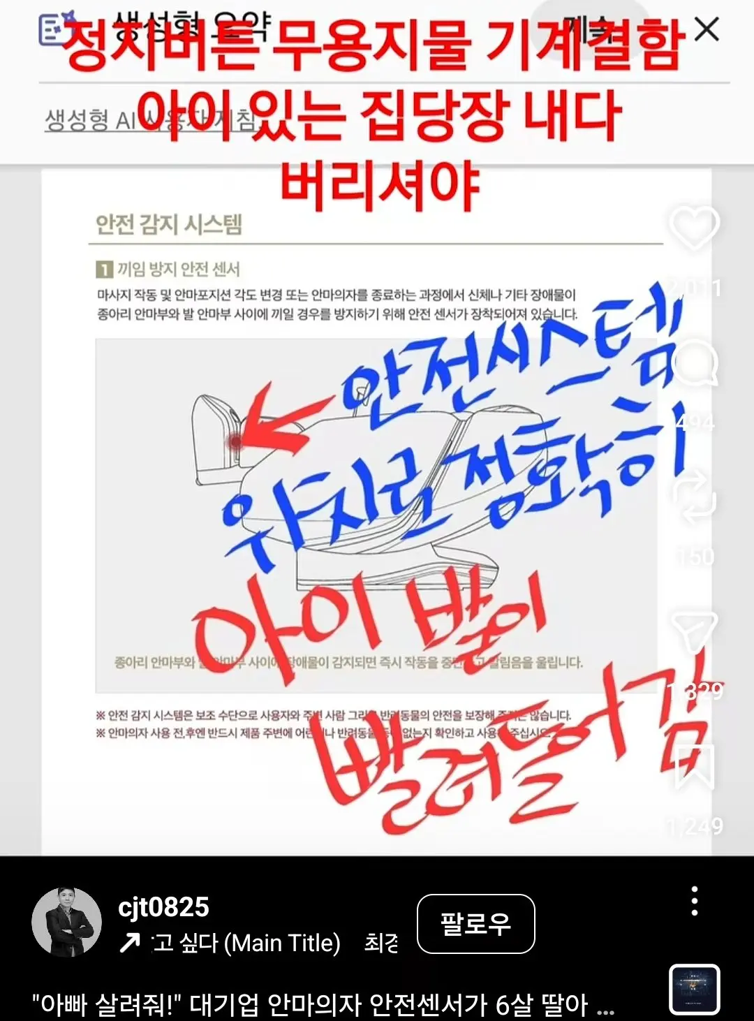 안마의자에 발 뼈가 분쇄된 6살 아이 (8)