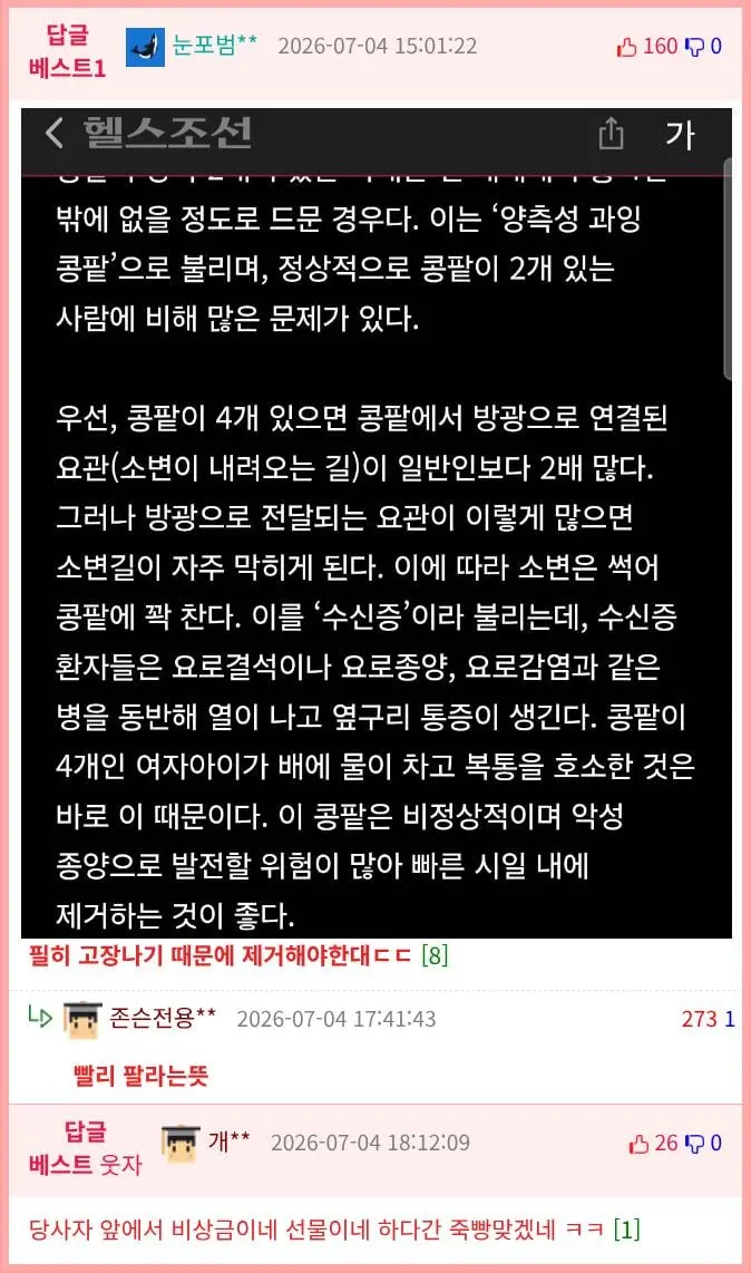 '하늘이 준 비상금' 신장 4개인 남성 (2)