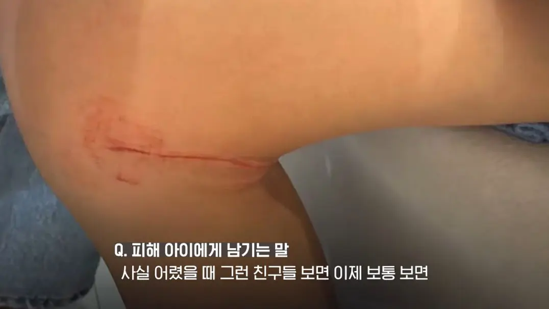 송도 돼지물림 사고 펫카페 사장 인터뷰 (54)
