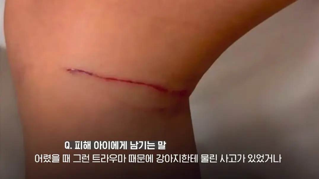 송도 돼지물림 사고 펫카페 사장 인터뷰 (55)