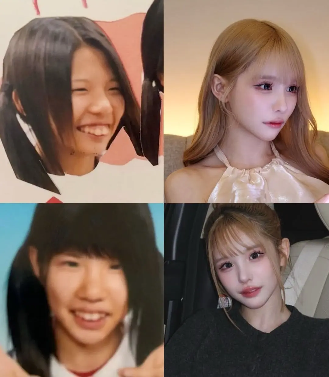 성형수술에 2억 4천만원 쓰고 과거 사진 공개한 여자 (2)