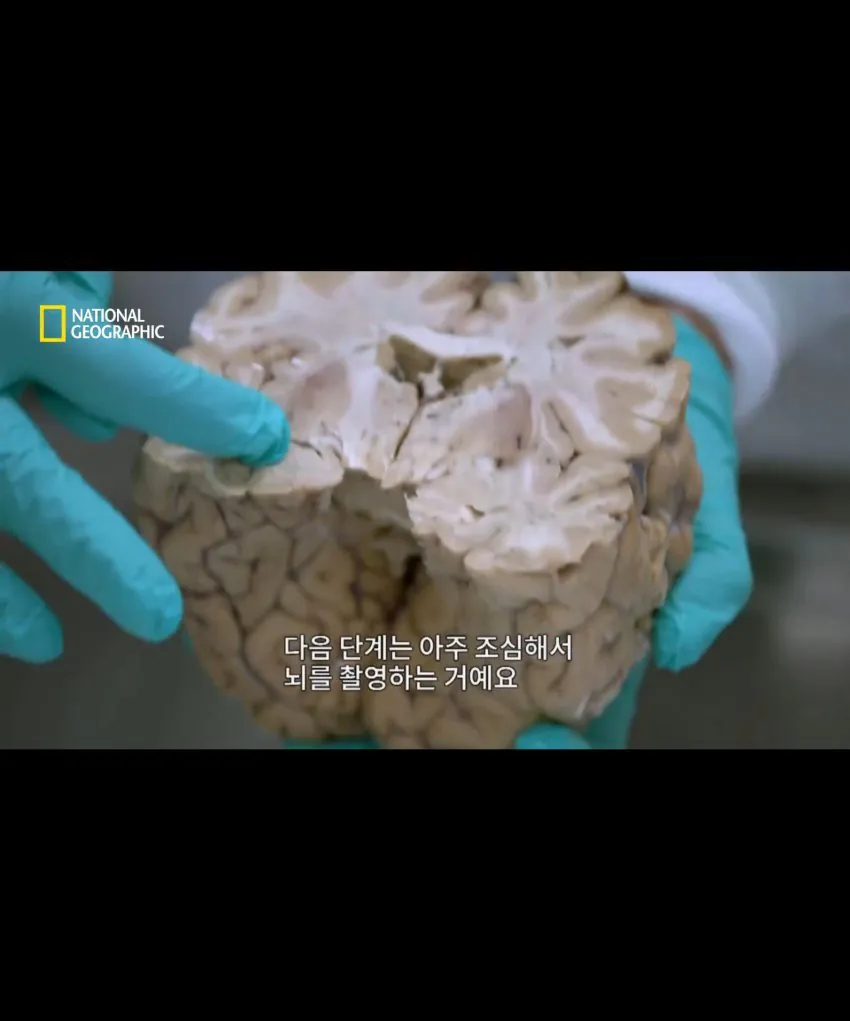 축구 헤딩의 위험성 (2)