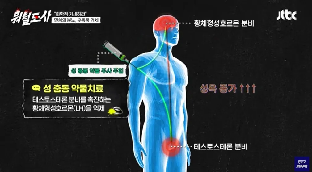 국내 1호 '화학적 거세'자 (2)