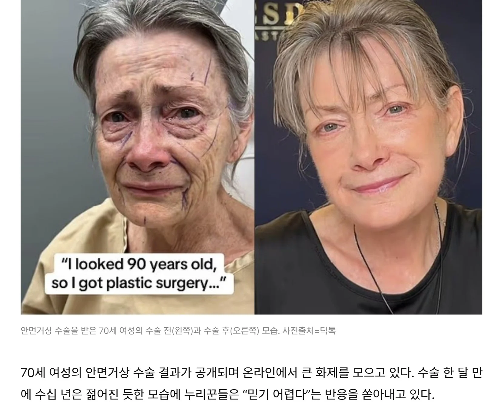 요즘 서양인들이 젊어보이는 이유 (4)